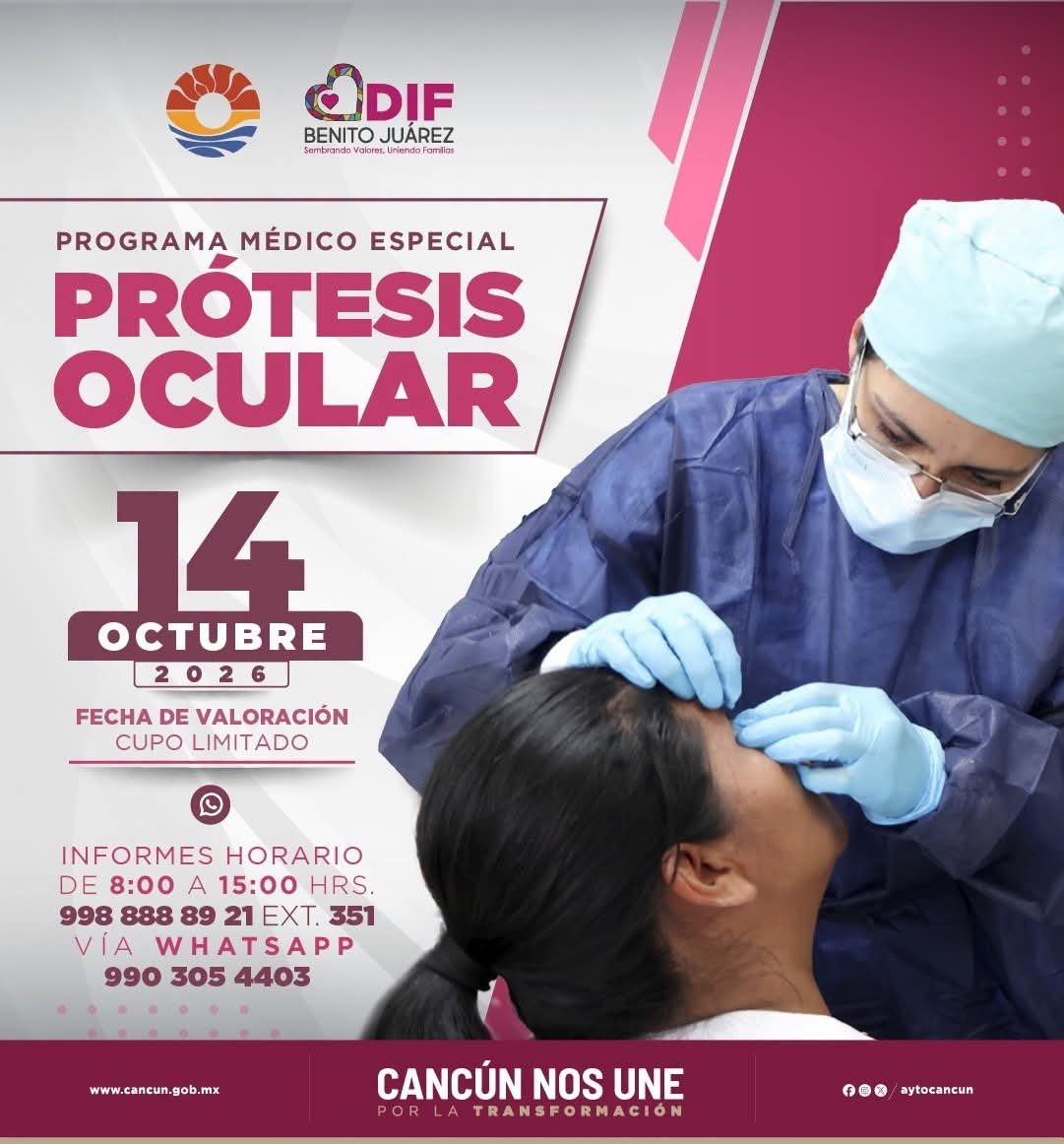 FORTALECE DIF BENITO JUÁREZ PROGRAMA MÉDICO DE PRÓTESIS OCULARES 2026